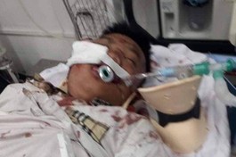 Mở rộng lòng từ: Thiếu niên nghèo gặp tai nạn nghiêm trọng